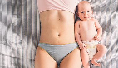 What Is Diastasis Recti & How Do I Know if I Have it?